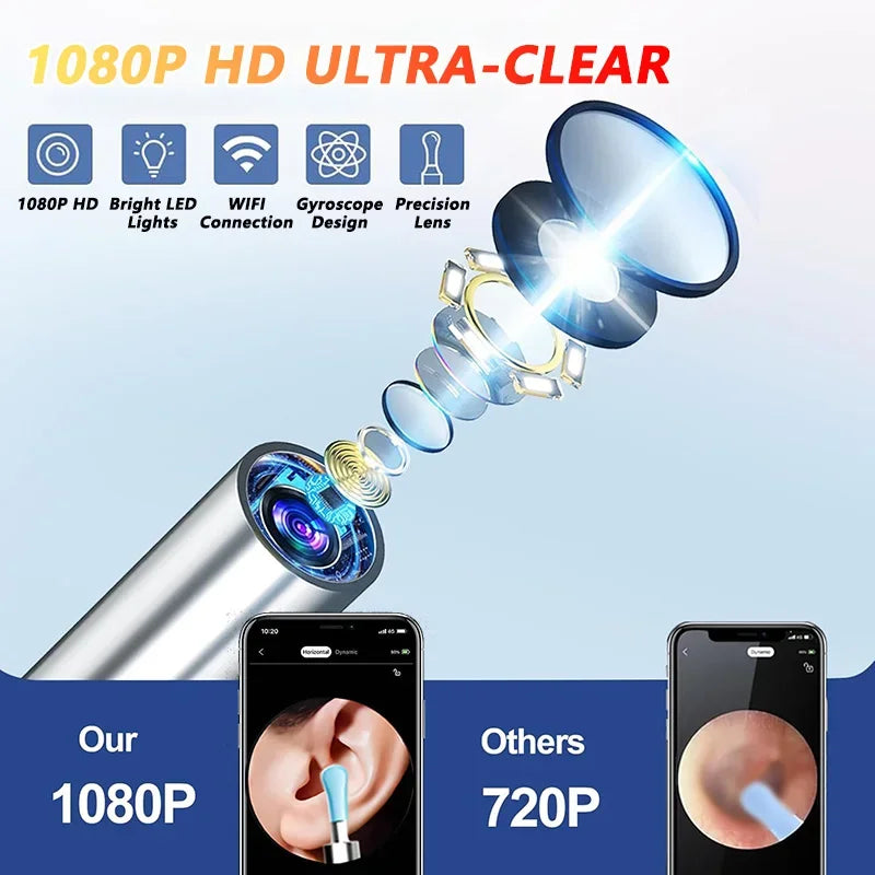 Smart Visual Ear Wax Cleaner With Camera